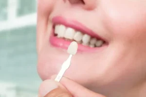 Exploring Broken Veneers in Dentistry: Causes, Solutions, and Prevention